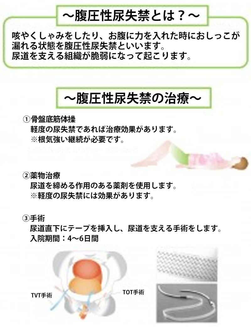 腹圧性尿失禁とは?